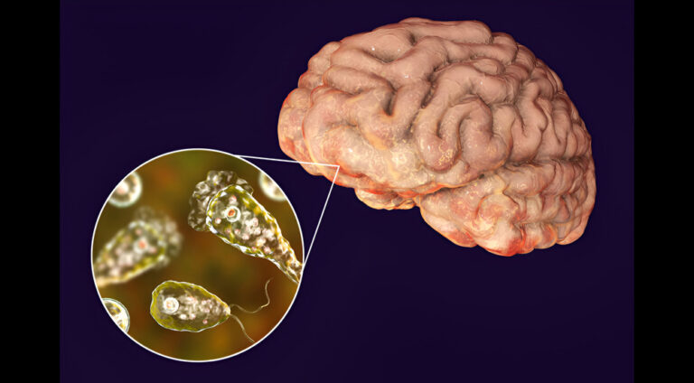 Kerala Records Fourth Case of Rare Brain-Eating Amoeba Infection: Report
